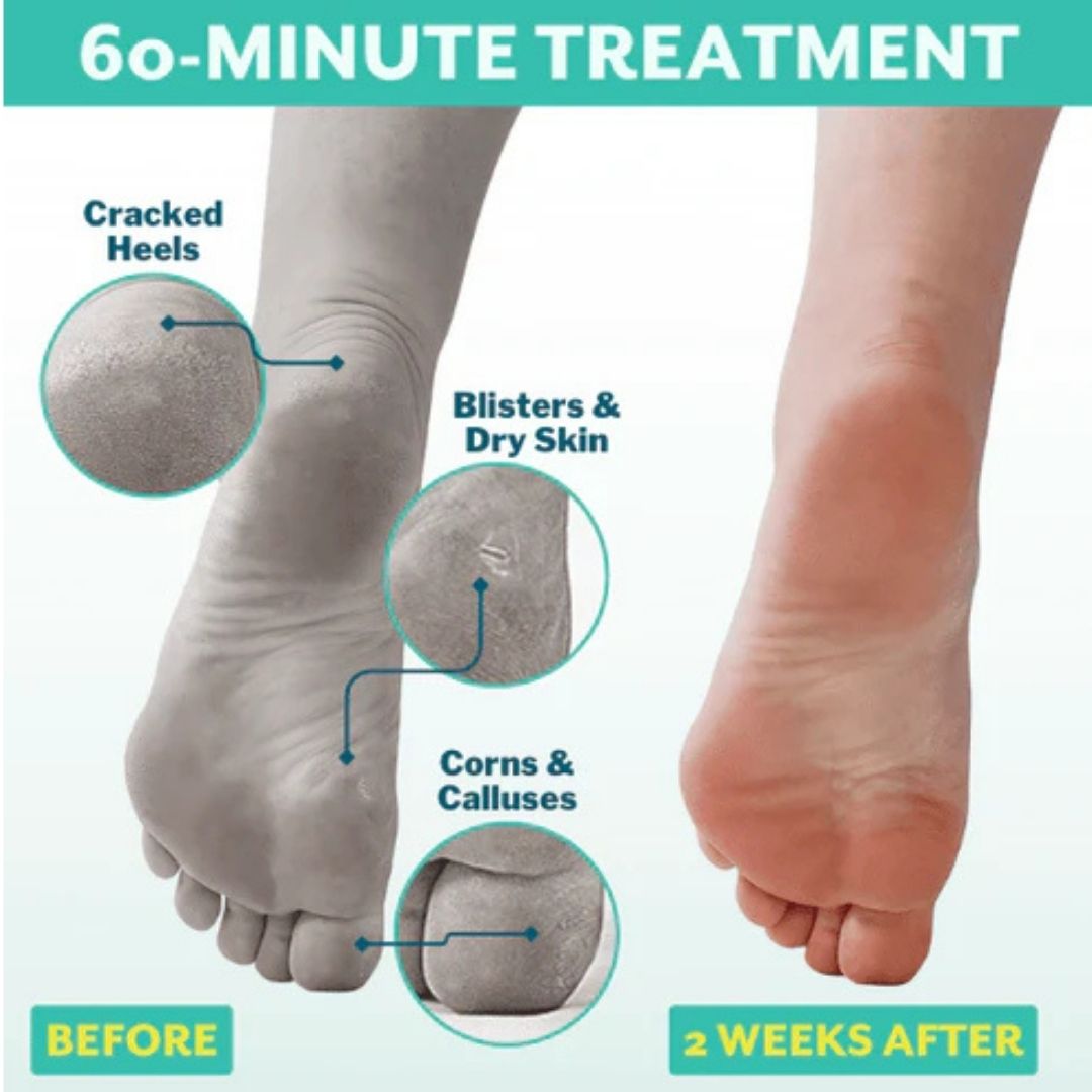 POSHPEEL Pedi Cure
